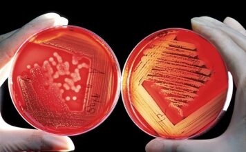 Jaka minimalna grubość kleju pod płytki? Jaka minimalna grubość kleju pod płytki?